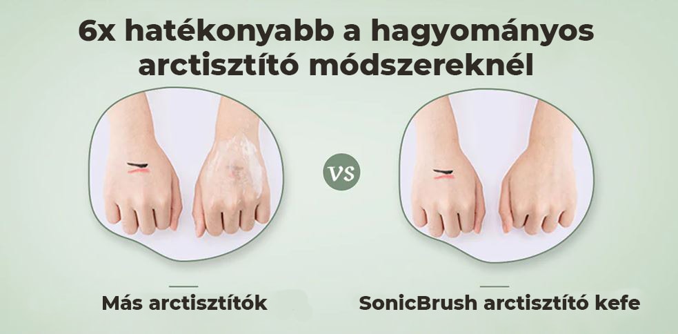 SonicBrush arctisztító kefe